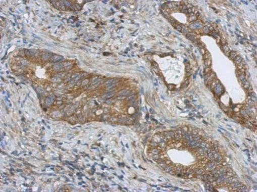 PITPNC1 Antibody in Immunohistochemistry (Paraffin) (IHC (P))