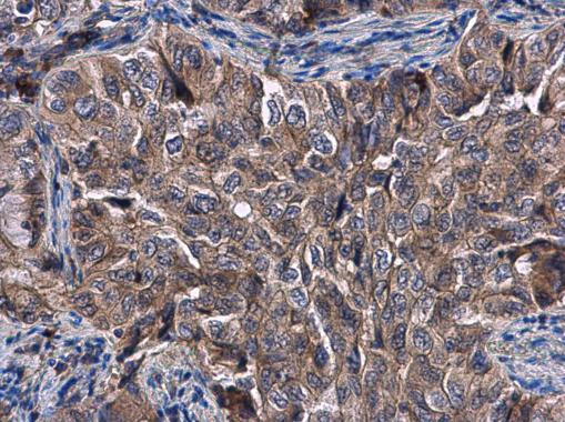 KLHL3 Antibody in Immunohistochemistry (Paraffin) (IHC (P))