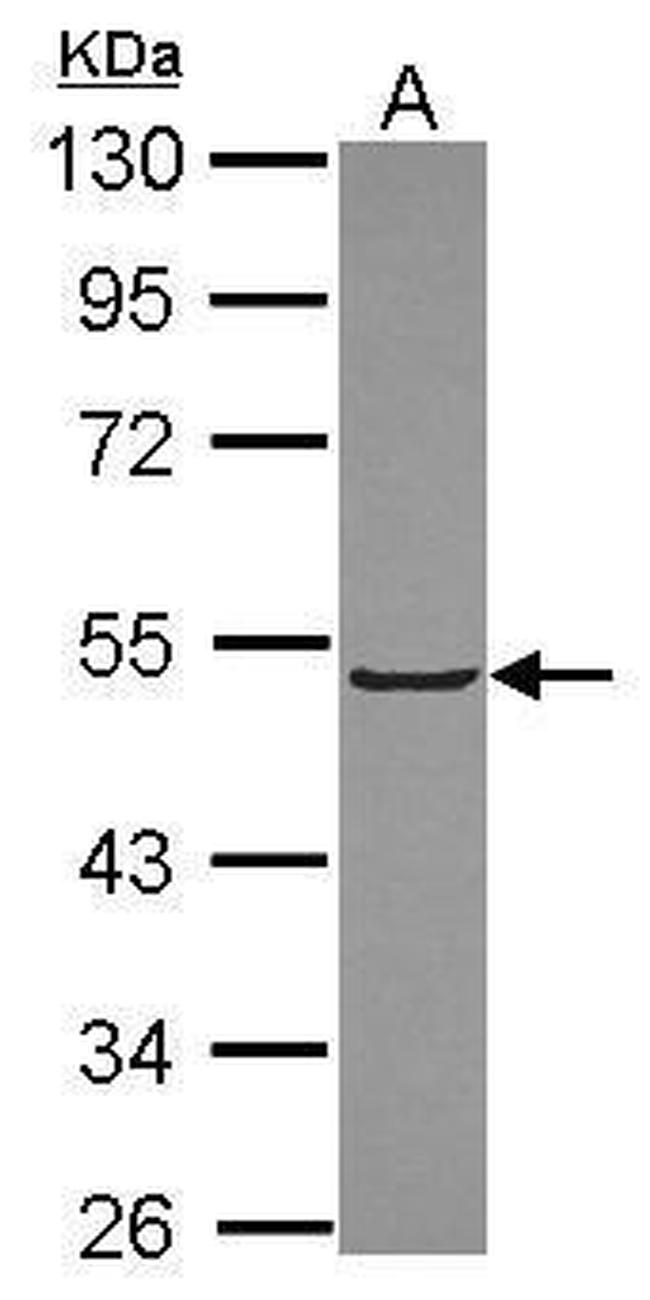 KLHL3 Antibody in Western Blot (WB)