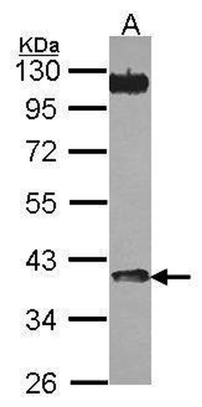 CHIA Antibody in Western Blot (WB)