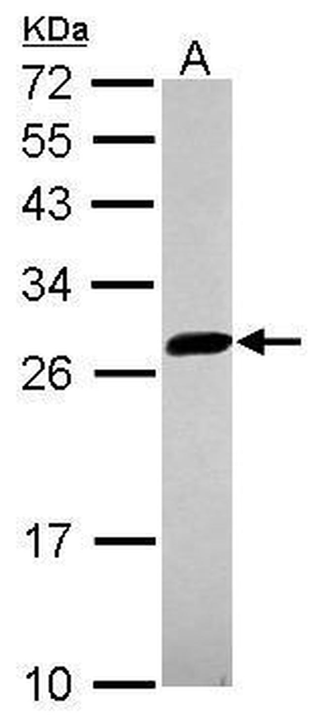 UBE2S Antibody in Western Blot (WB)