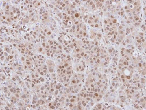 DCPS Antibody in Immunohistochemistry (Paraffin) (IHC (P))