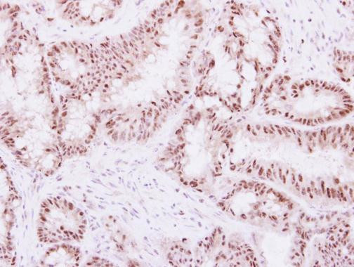 WDR91 Antibody in Immunohistochemistry (Paraffin) (IHC (P))