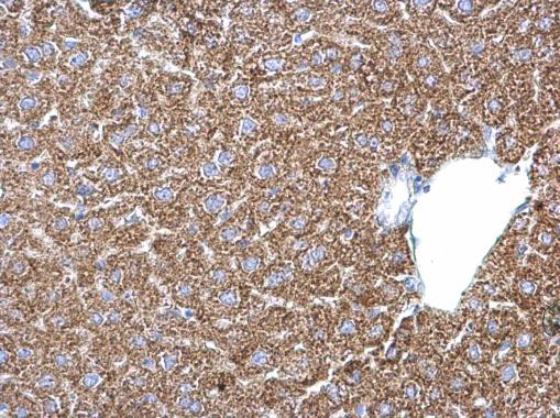 PSAT1 Antibody in Immunohistochemistry (Paraffin) (IHC (P))