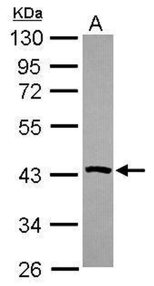 PSAT1 Antibody in Western Blot (WB)