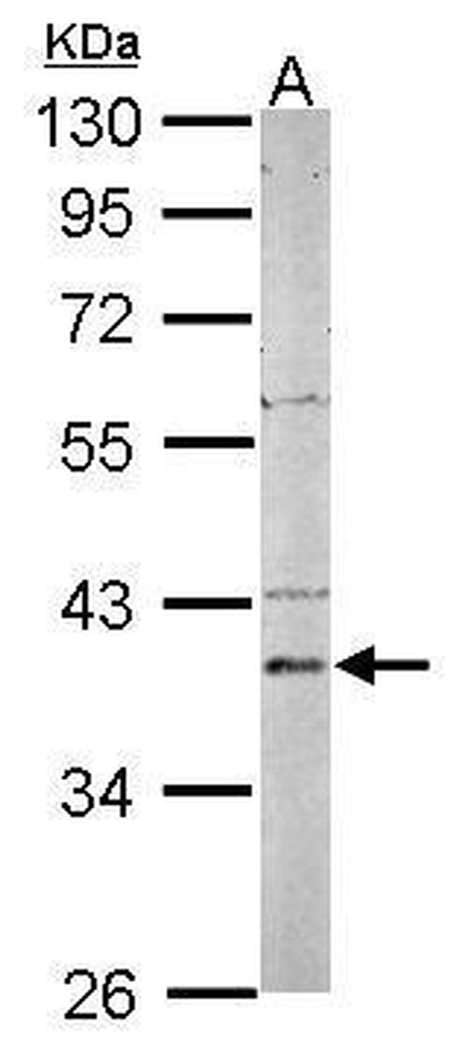 PSAT1 Antibody in Western Blot (WB)