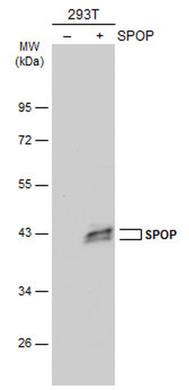 SPOP Antibody in Western Blot (WB)