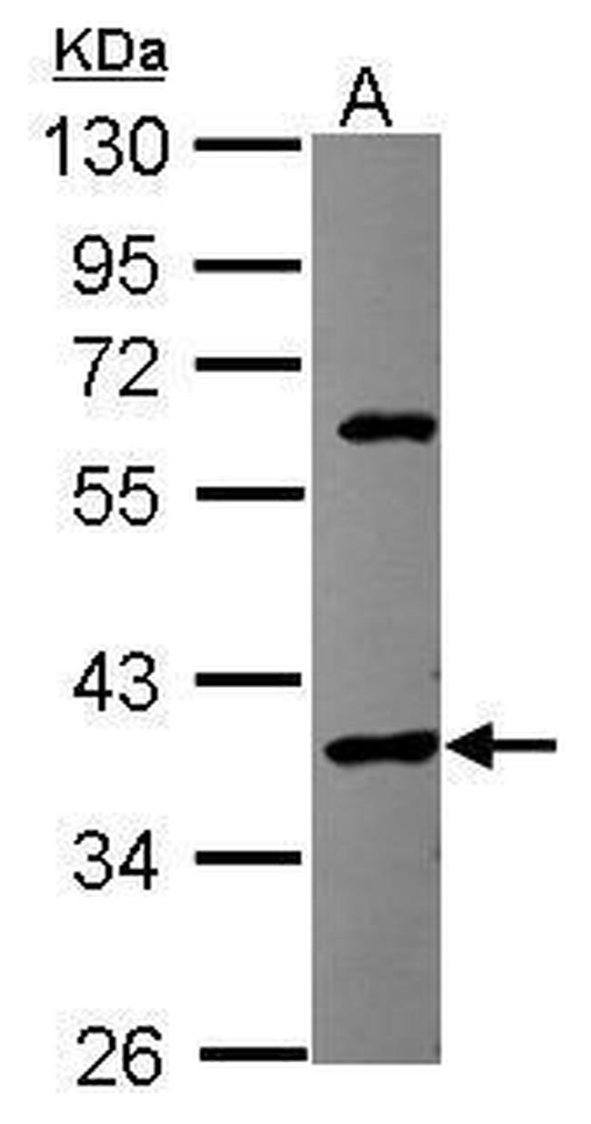 SPOP Antibody in Western Blot (WB)