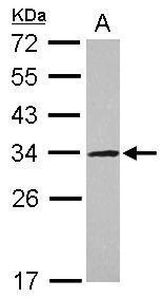 UTP11L Antibody in Western Blot (WB)