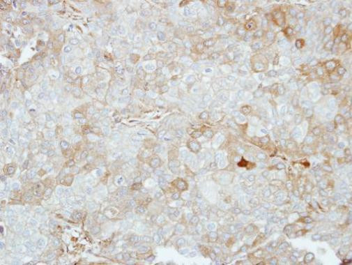 VPS28 Antibody in Immunohistochemistry (Paraffin) (IHC (P))