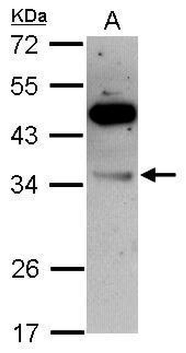 VPS28 Antibody in Western Blot (WB)