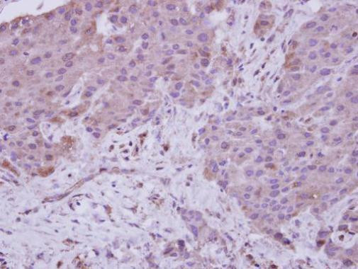 NAA15 Antibody in Immunohistochemistry (Paraffin) (IHC (P))