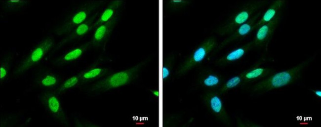 QKI Antibody in Immunocytochemistry (ICC/IF)