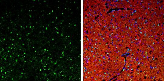 QKI Antibody in Immunohistochemistry (Frozen) (IHC (F))