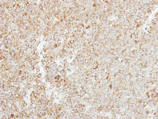 MTHFS Antibody in Immunohistochemistry (Paraffin) (IHC (P))