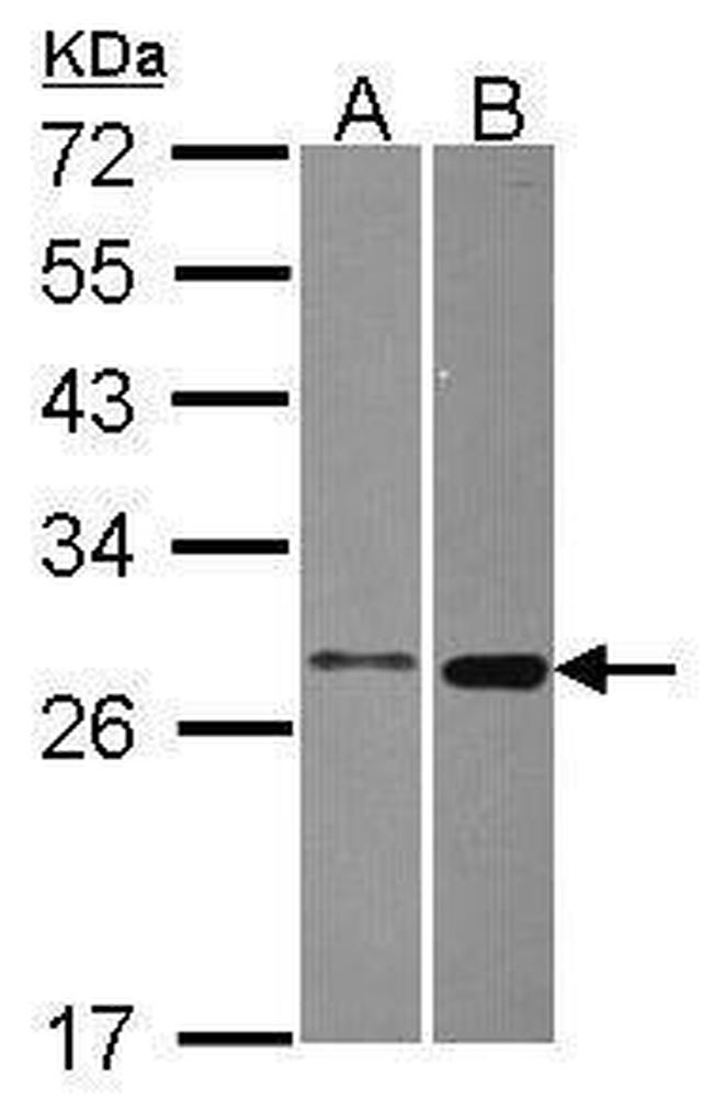 MTHFS Antibody in Western Blot (WB)