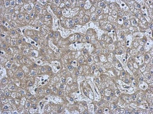 NMT2 Antibody in Immunohistochemistry (Paraffin) (IHC (P))