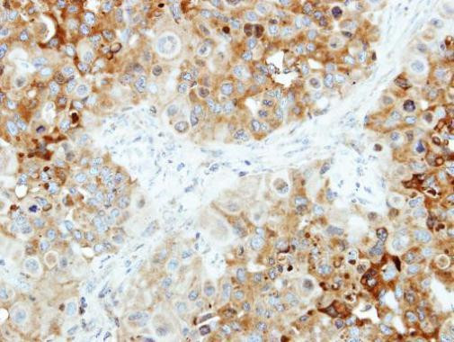 B4GALT4 Antibody in Immunohistochemistry (Paraffin) (IHC (P))