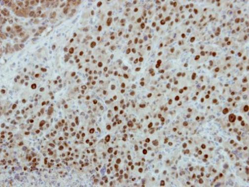 POLR1D Antibody in Immunohistochemistry (Paraffin) (IHC (P))