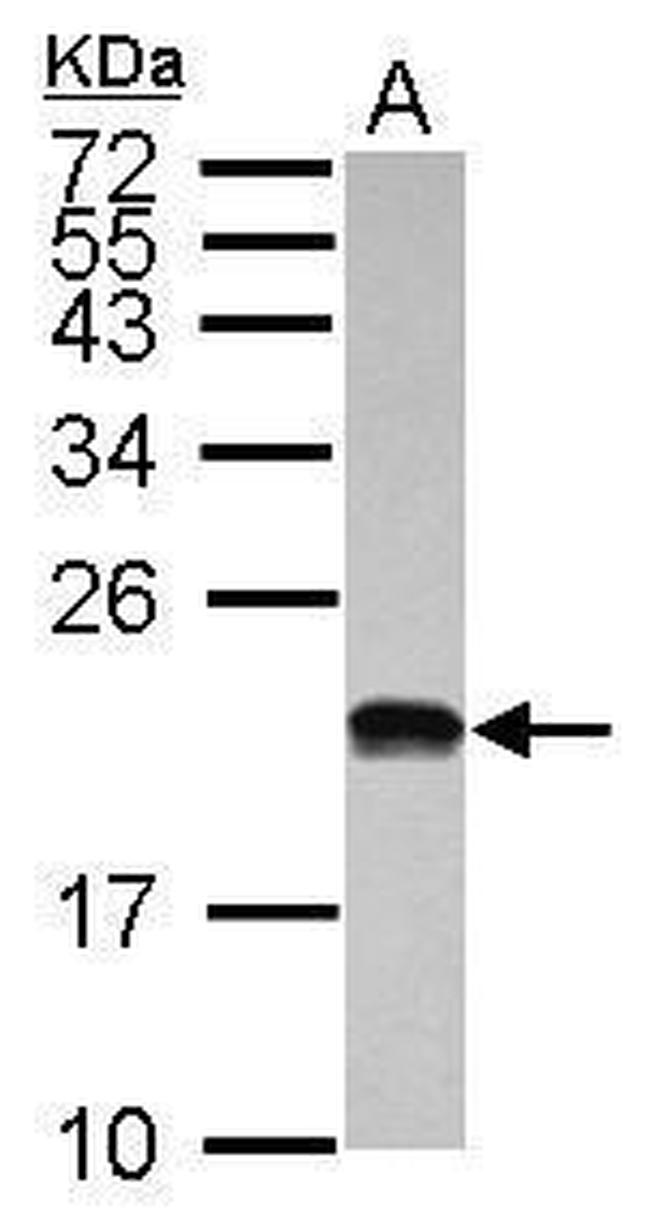 POLR1D Antibody in Western Blot (WB)