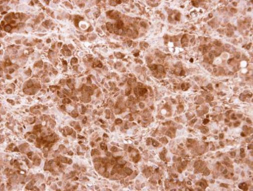 PRMT5 Antibody in Immunohistochemistry (Paraffin) (IHC (P))