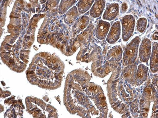 PRMT5 Antibody in Immunohistochemistry (Paraffin) (IHC (P))