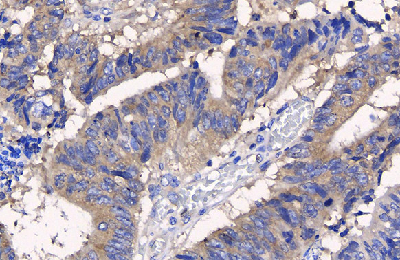 Protein APC Antibody in Immunohistochemistry (Paraffin) (IHC (P))