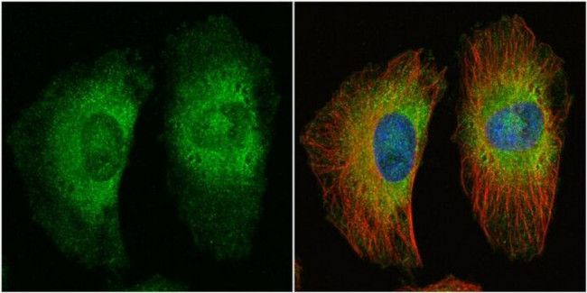 Protein APC Antibody in Immunocytochemistry (ICC/IF)