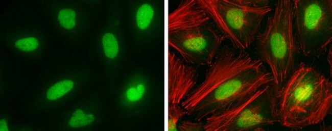 DNMT1 Antibody in Immunocytochemistry (ICC/IF)