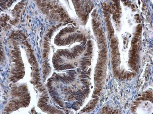 DNMT1 Antibody in Immunohistochemistry (Paraffin) (IHC (P))