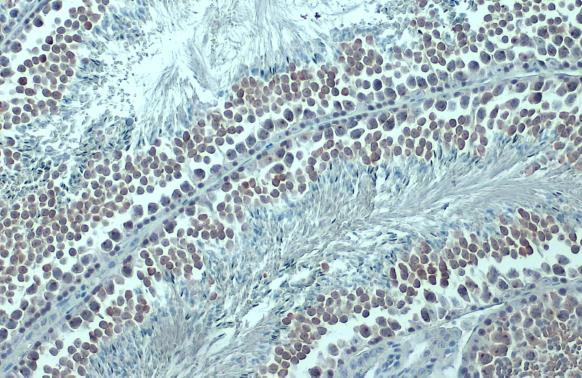 DNMT1 Antibody in Immunohistochemistry (Paraffin) (IHC (P))