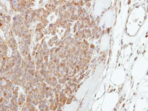 Involucrin Antibody in Immunohistochemistry (Paraffin) (IHC (P))