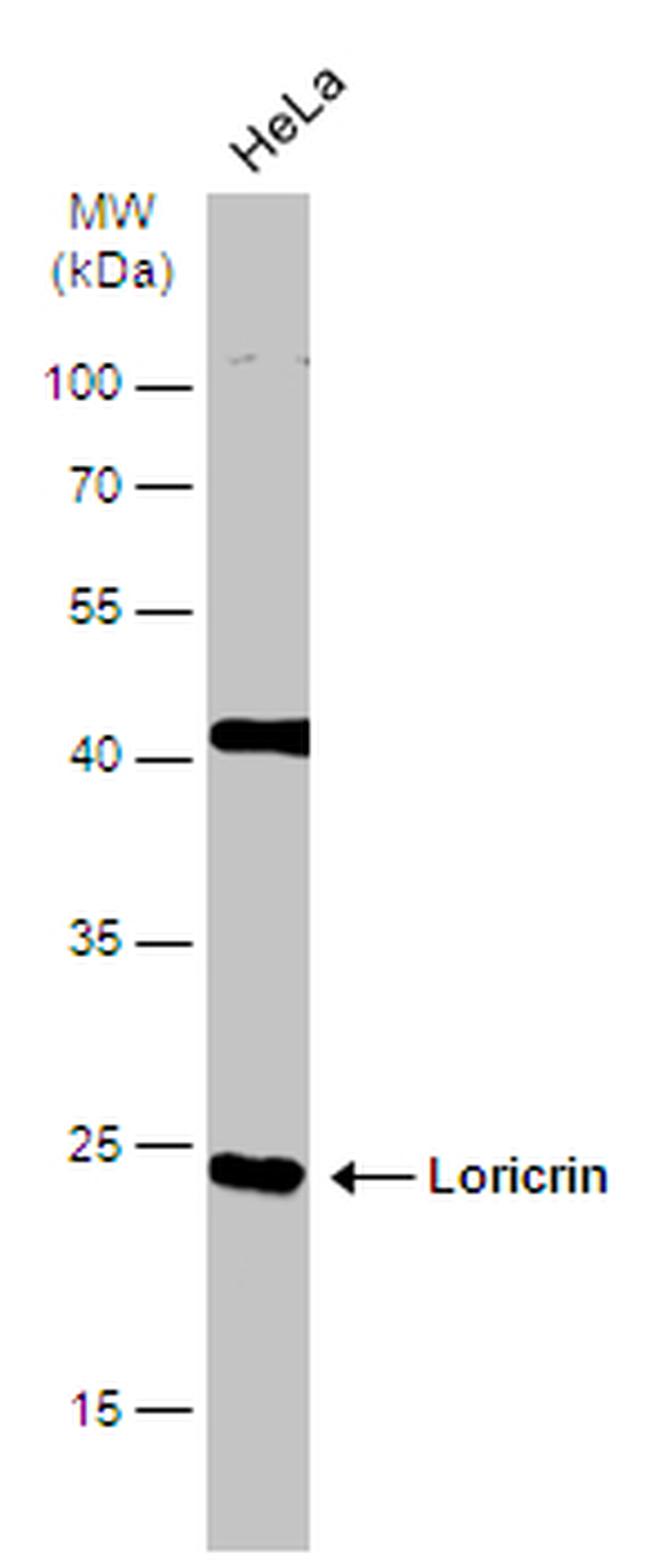 LOR Antibody in Western Blot (WB)