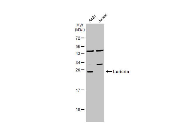 LOR Antibody in Western Blot (WB)