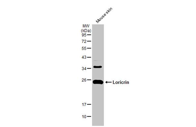 LOR Antibody in Western Blot (WB)