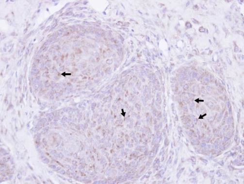 Presenilin 1 Antibody in Immunohistochemistry (Paraffin) (IHC (P))