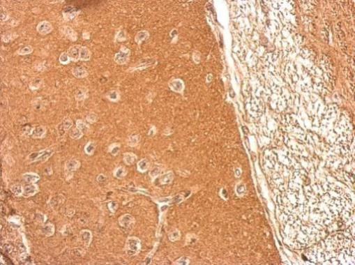 Presenilin 1 Antibody in Immunohistochemistry (Paraffin) (IHC (P))