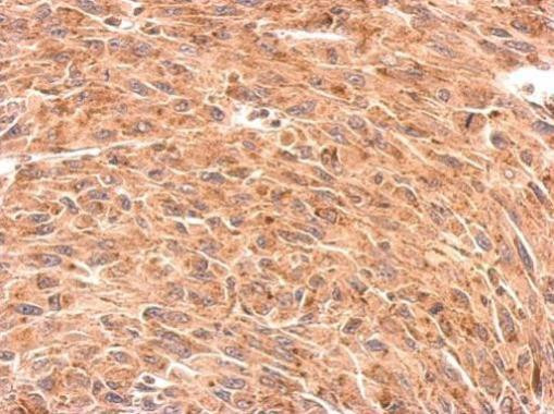 Presenilin 1 Antibody in Immunohistochemistry (Paraffin) (IHC (P))