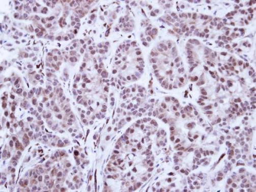 TAL1 Antibody in Immunohistochemistry (Paraffin) (IHC (P))