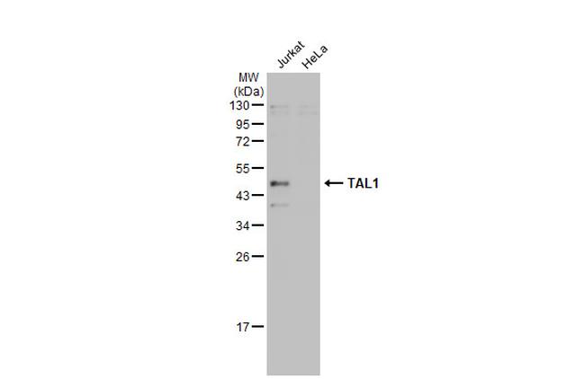 TAL1 Antibody in Western Blot (WB)