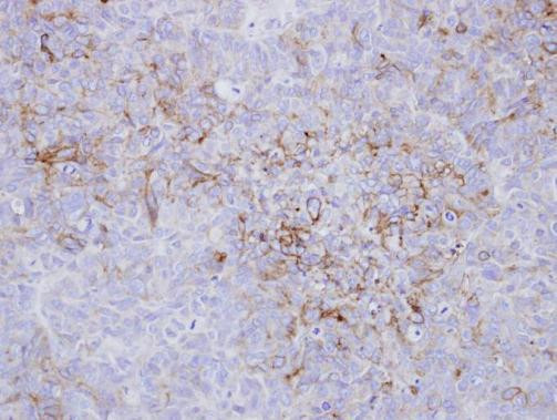 Endothelin A Receptor Antibody in Immunohistochemistry (Paraffin) (IHC (P))