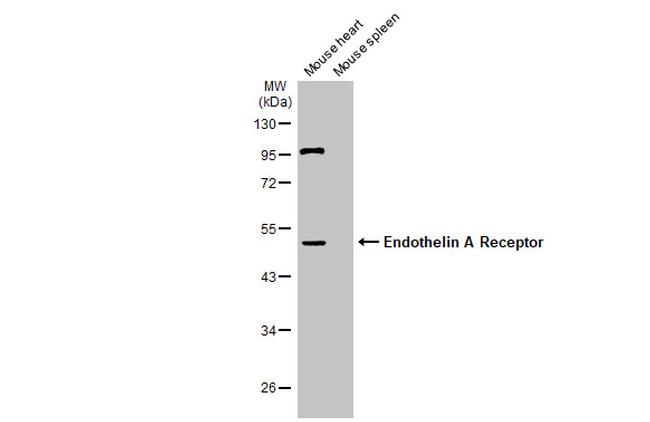 Endothelin A Receptor Antibody in Western Blot (WB)