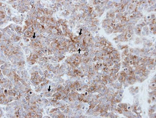 PAR1 Antibody in Immunohistochemistry (Paraffin) (IHC (P))