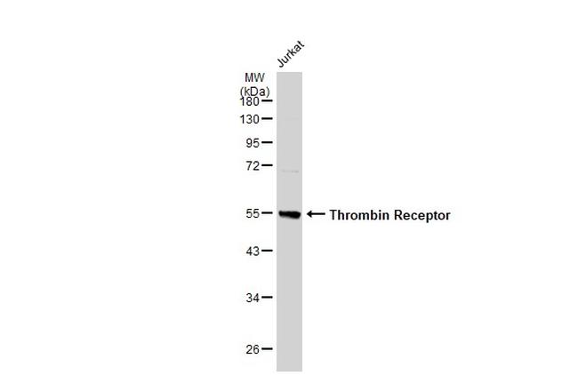 PAR1 Antibody in Western Blot (WB)