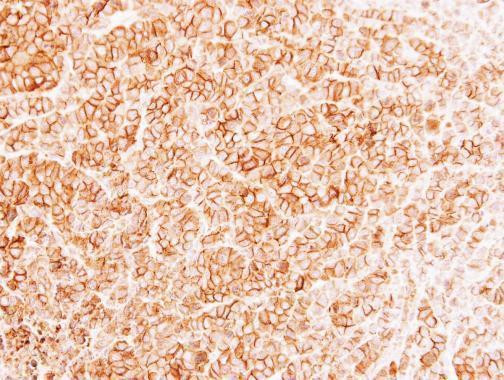 MRP1 Antibody in Immunohistochemistry (Paraffin) (IHC (P))