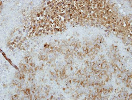 TAS1R1 Antibody in Immunohistochemistry (Paraffin) (IHC (P))