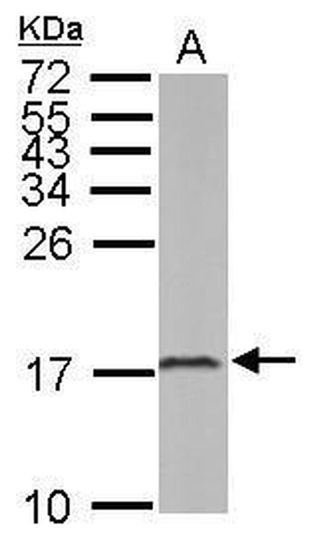 LC3B Antibody in Western Blot (WB)