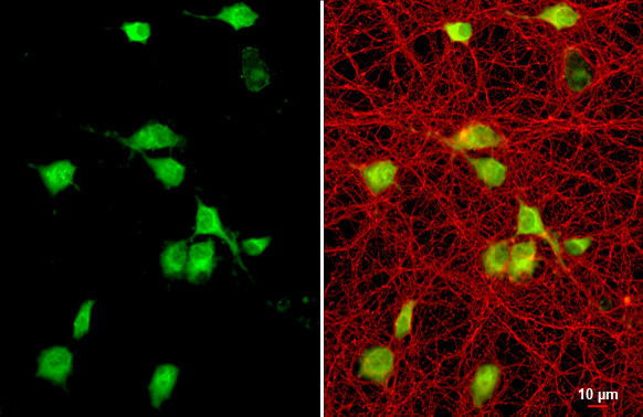 CXCL12 Antibody in Immunocytochemistry (ICC/IF)