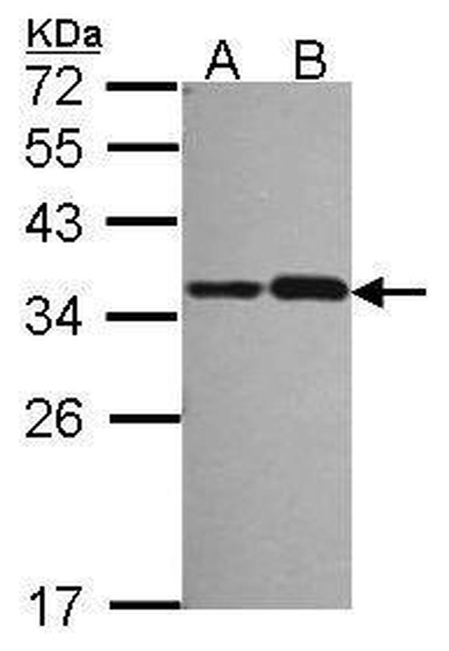 NOSIP Antibody in Western Blot (WB)