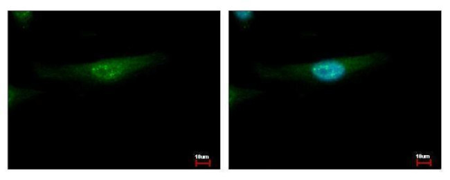 YBX2 Antibody in Immunocytochemistry (ICC/IF)